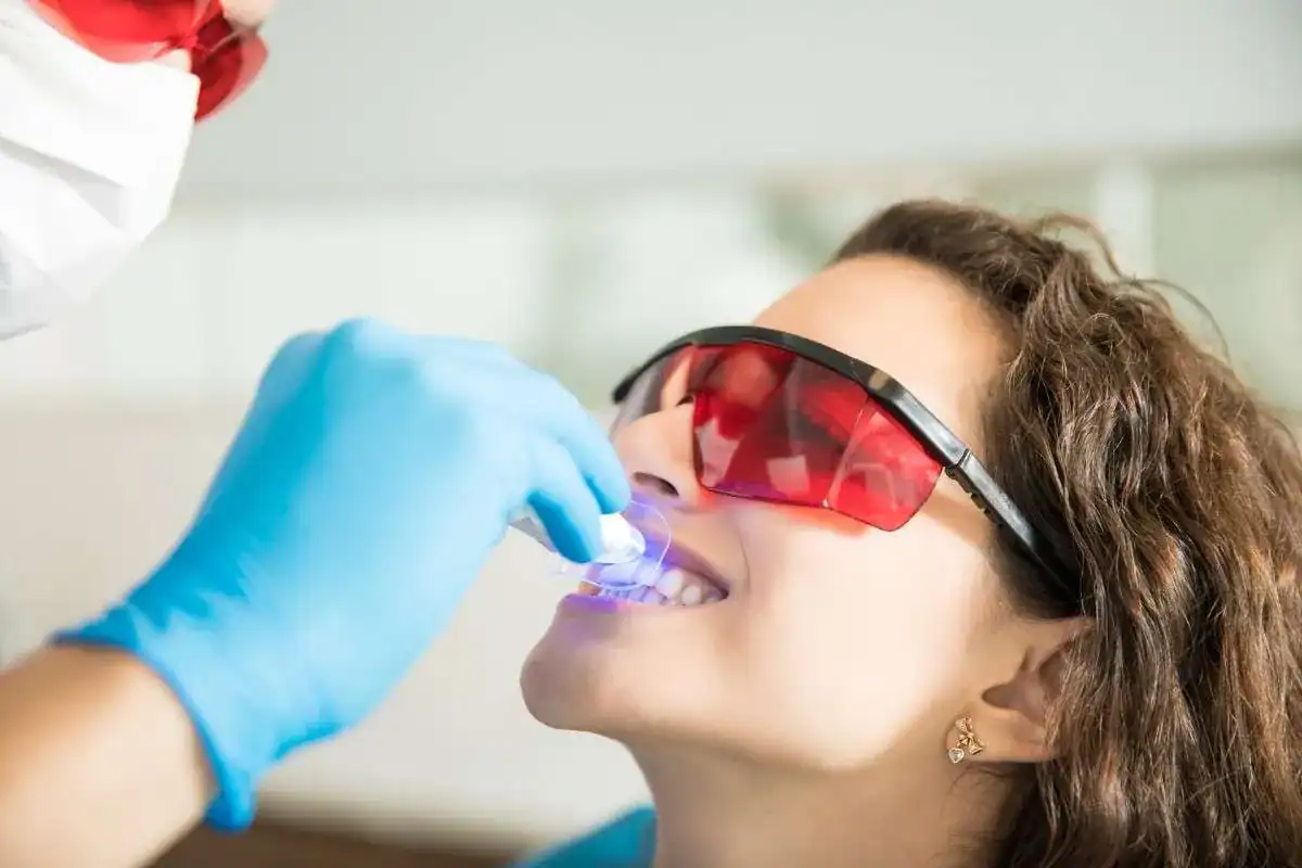 How Do People With Veneers Manage Expectations Around Teeth Whitening Leamington Spa